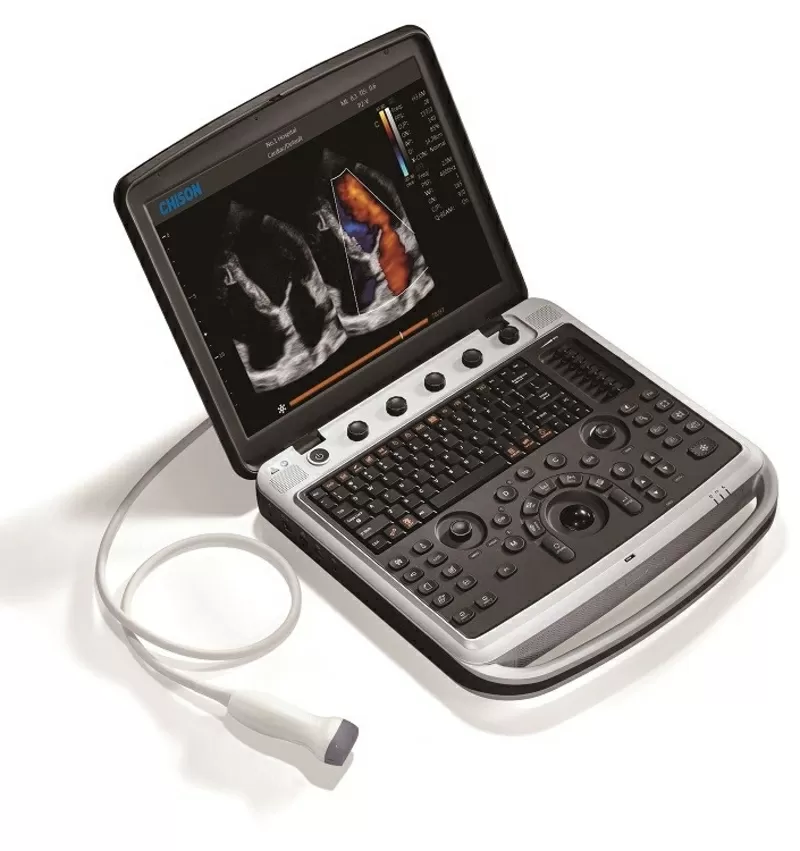 Аппарат УЗИ Chison SonoBook 9 с двумя датчиками